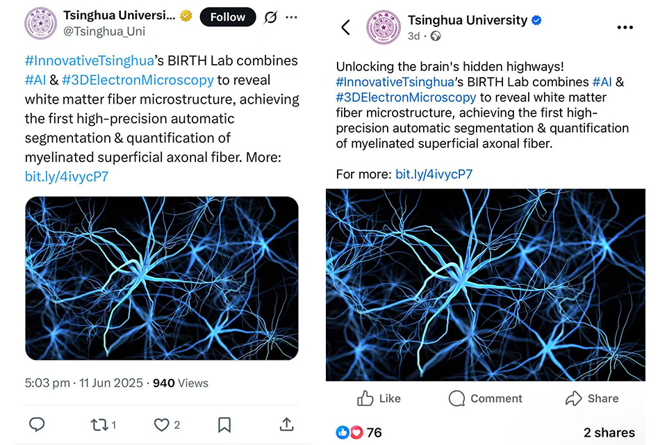 20250617-清华大学生物医学工程学院 BIRTH 实验室人脑白质短联络神经纤维研究成果获全球推广